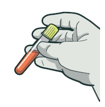 [image] illustration of a gloved hand holding a sealed vial of blood