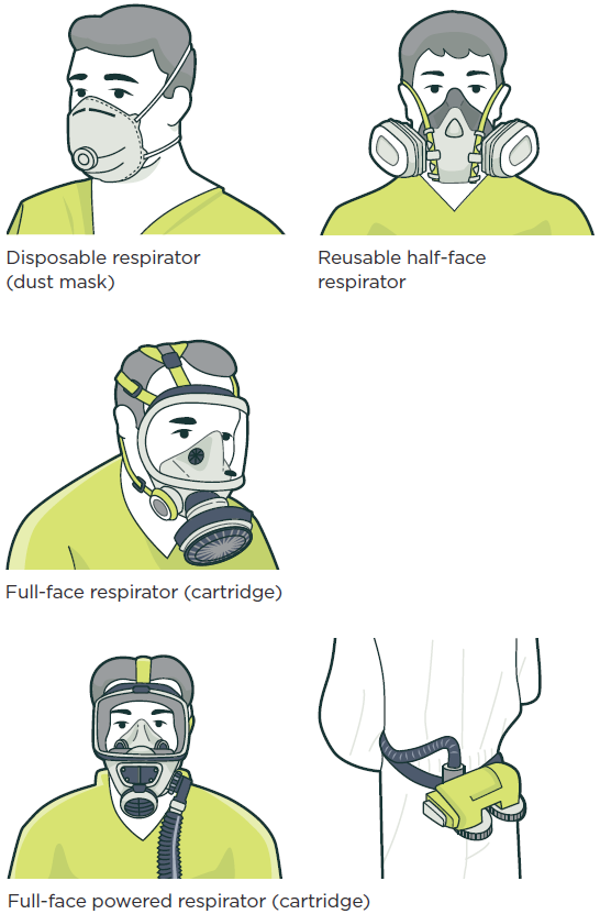 WKS image common types of RPE